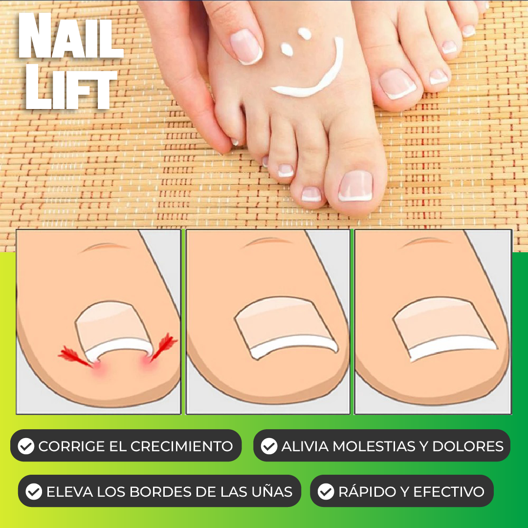 2X1 / NailLift™ - Parches para Uñas Encarnadas