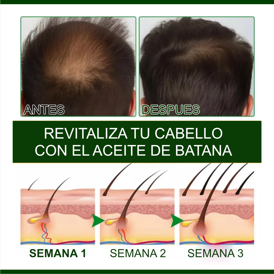 🛍️ BATANA OIL 2X1 – LLEVA 2, PAGA 1 TRATAMIENTO PREMIUN CAPILAR CON ENVIO GRATIS✨