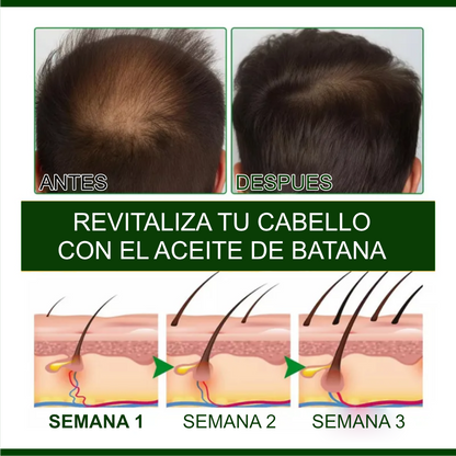 🛍️ BATANA OIL 2X1 – LLEVA 2, PAGA 1 TRATAMIENTO PREMIUN CAPILAR CON ENVIO GRATIS✨